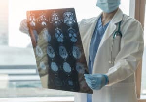Alzheimer's research